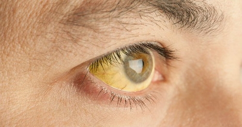 Màu mắt nói gì về sức khỏe của bạn1